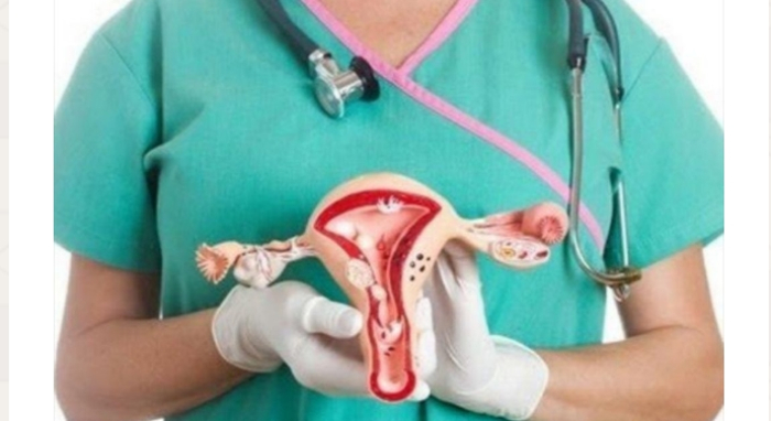 Waspada Kanker Serviks! Perempuan Diimbau Manfaatkan IVA Test Gratis di Puskesmas, Simak Penjelasan Plt kadiskes Pekanbaru 
