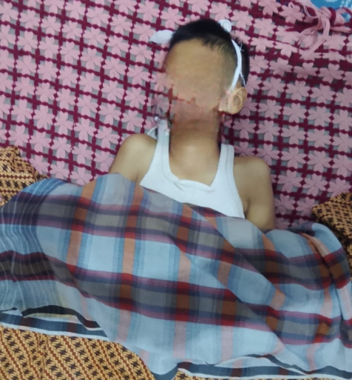 Murid SD di Pekanbaru Tewas, Diduga Setelah Dibully Teman Sekelas